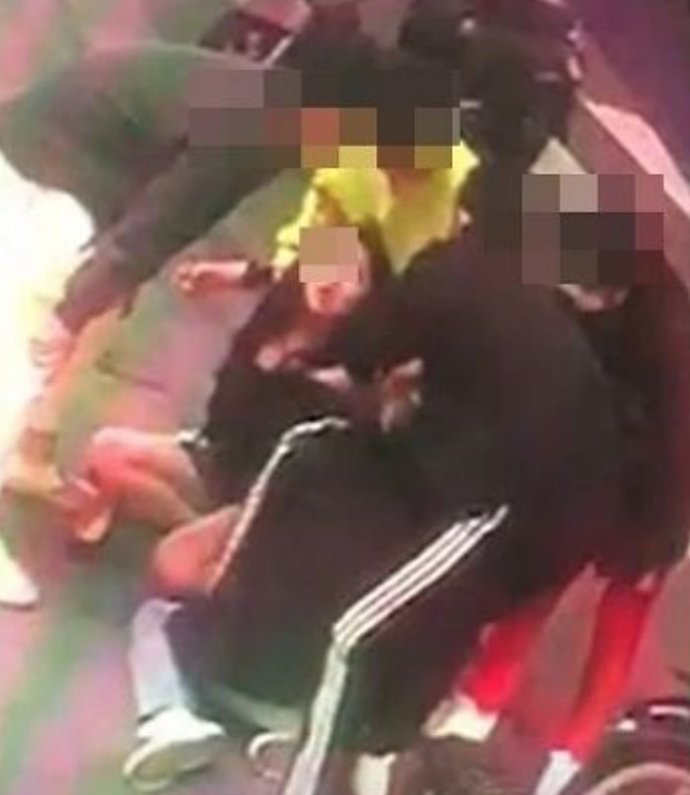 Người mẫu khiếm thính Hàn bị đánh đến chấn động não vì vô tình va phải người phụ nữ ảnh 3