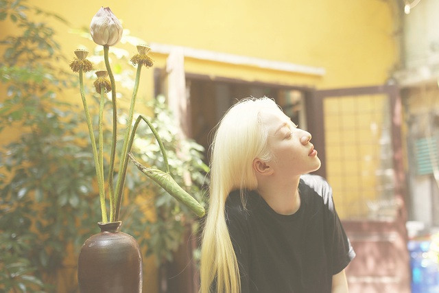 Nữ sinh bạch tạng sở hữu vẻ đẹp như nàng công chúa tuyết ảnh 7