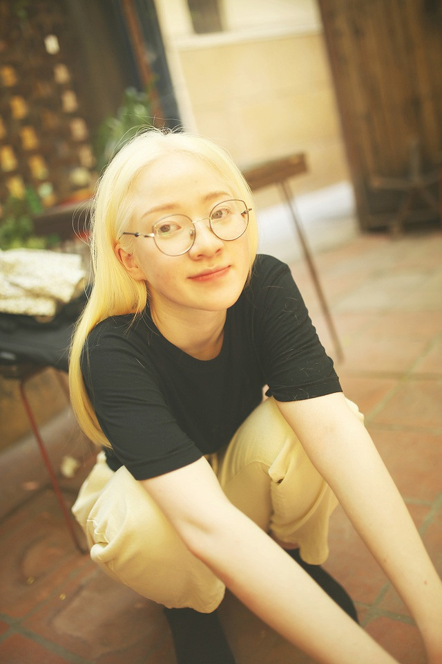 Nữ sinh bạch tạng sở hữu vẻ đẹp như nàng công chúa tuyết ảnh 9