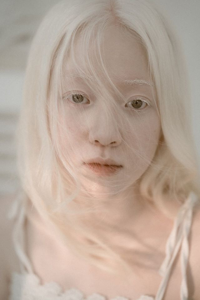 Nữ sinh bạch tạng sở hữu vẻ đẹp như nàng công chúa tuyết ảnh 4