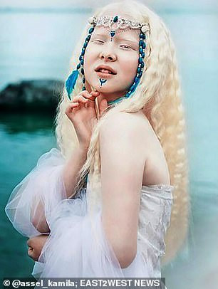 Diện mạo khác lạ của hai chị em người Kazakhstan bị bạch tạng gây 'sốt' ảnh 4