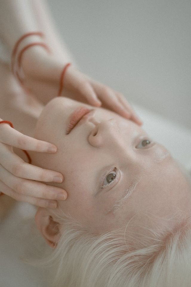 Nữ sinh bạch tạng sở hữu vẻ đẹp như nàng công chúa tuyết ảnh 2