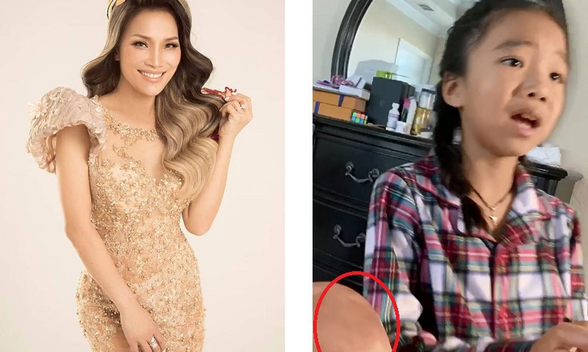 Showbiz 19/5: Nam ca sĩ bị tai nạn, chấn thương sọ não và liệt nửa mặt ảnh 3