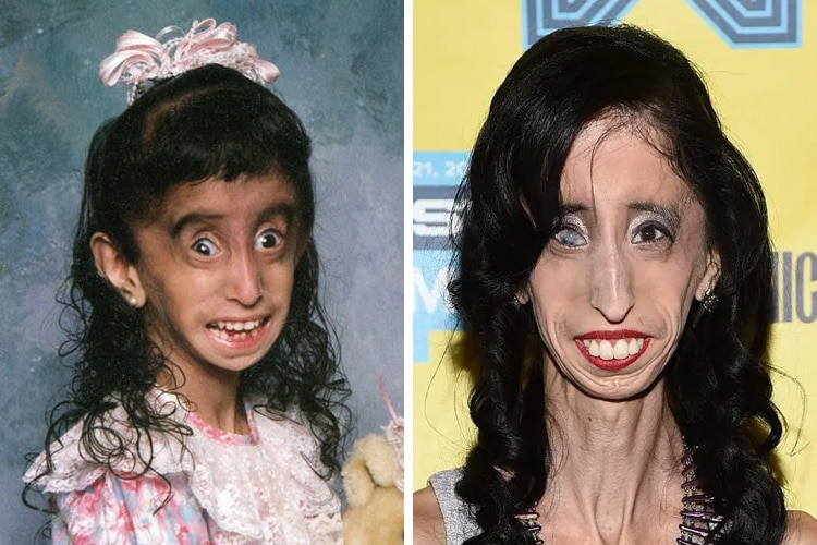 Cô gái bị cho xấu xí nhất thế giới cầu xin mọi người ngừng bắt nạt mình trên mạng ảnh 2