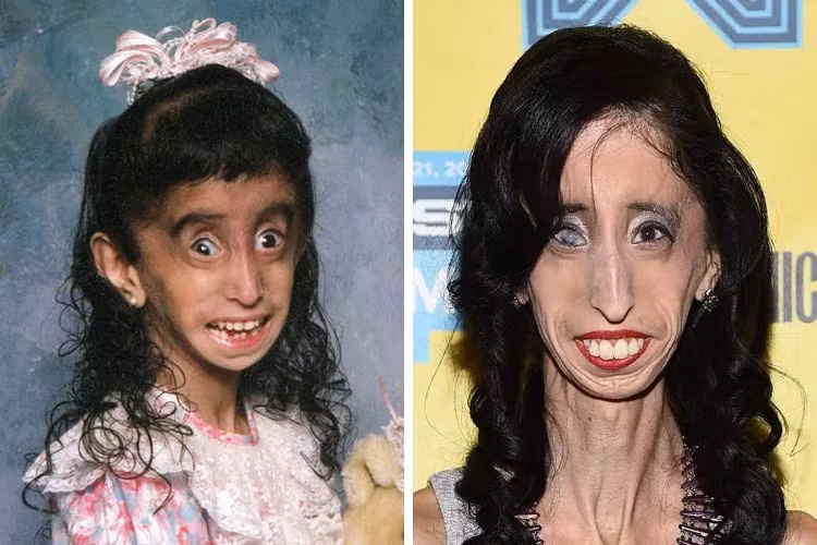 Cô gái bị cho xấu xí nhất thế giới cầu xin mọi người ngừng bắt nạt mình trên mạng ảnh 2