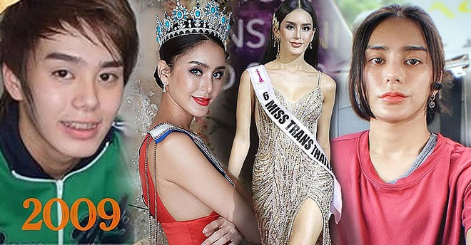 Hoa hậu chuyển giới Thái Lan gây sốc vì phẫu thuật trở lại thành nam giới ảnh 2