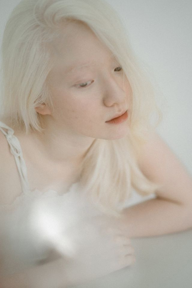 Nữ sinh bạch tạng sở hữu vẻ đẹp như nàng công chúa tuyết ảnh 5