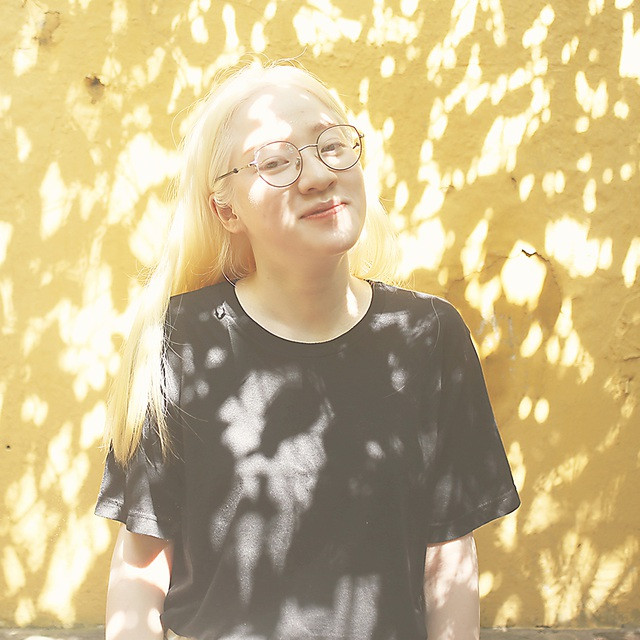 Nữ sinh bạch tạng sở hữu vẻ đẹp như nàng công chúa tuyết ảnh 8