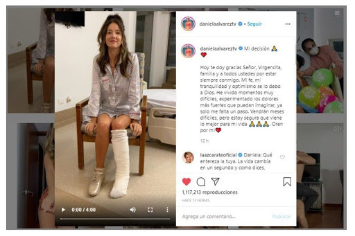 (Dòng trạng thái trên instagram của Daniella Álvarez, thông báo cô sẽ tiến hành phẫu thuật cắt bỏ chân trái). Hoa hậu Colombia phải cưa một chân ảnh 1