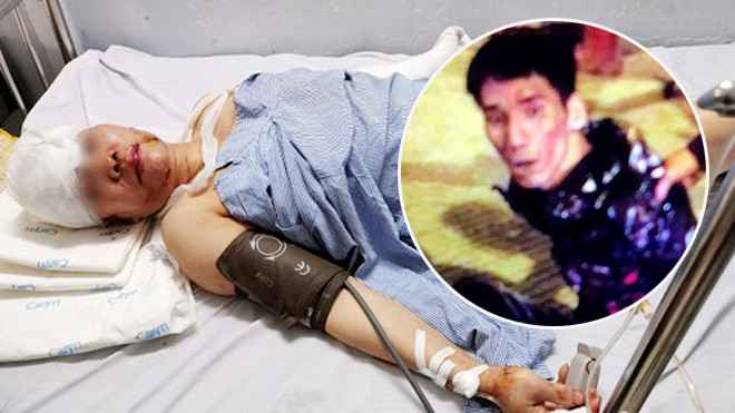 Kinh hoàng cảnh chủ nhà nghỉ bị chém hàng trăm nhát trong đêm ảnh 1