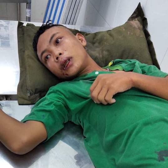 100 đối tượng vận chuyển thuốc lá lậu tấn công, 5 chiến sĩ bị thương ảnh 2