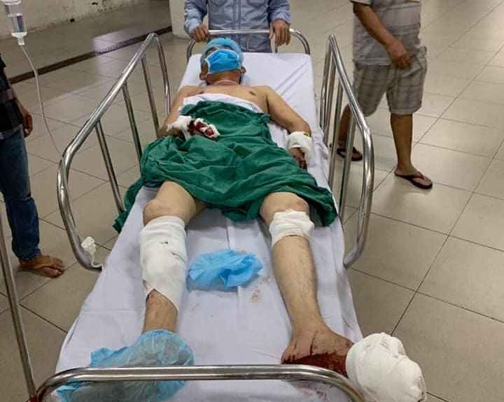  Bắt 2 nghi phạm chém người dã man tại cây xăng ảnh 3