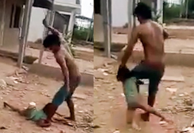 Diễn biến sức khỏe bé gái bị cha đánh đập dã man như thời trung cổ ảnh 2