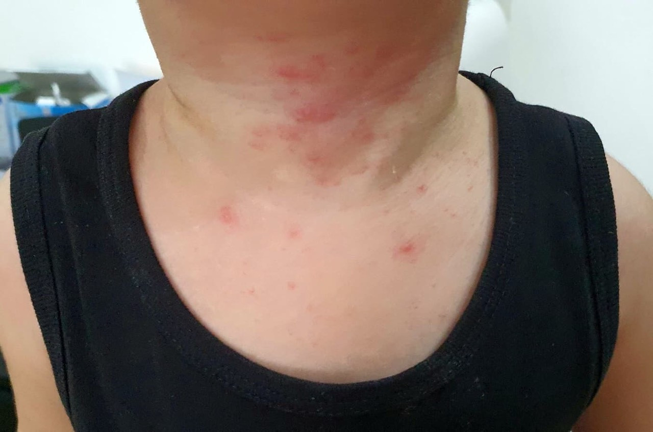 Ban quản lý tự ý pha thuốc diệt khuẩn, cư dân chung cư bị dị ứng? ảnh 1