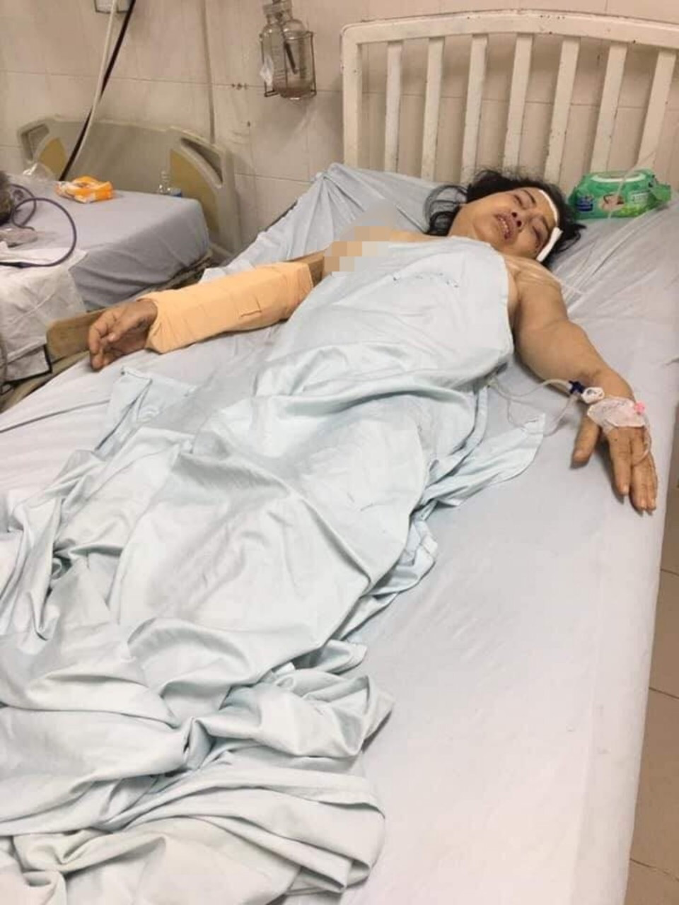 Bắt tạm giam chồng cũ đánh vợ gây thương tích ảnh 2