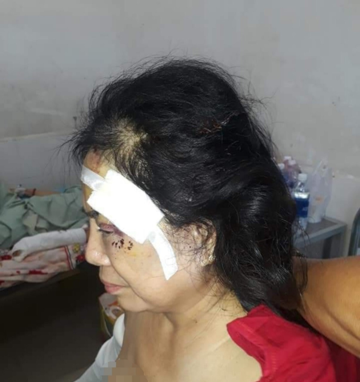 Bắt tạm giam chồng cũ đánh vợ gây thương tích ảnh 1