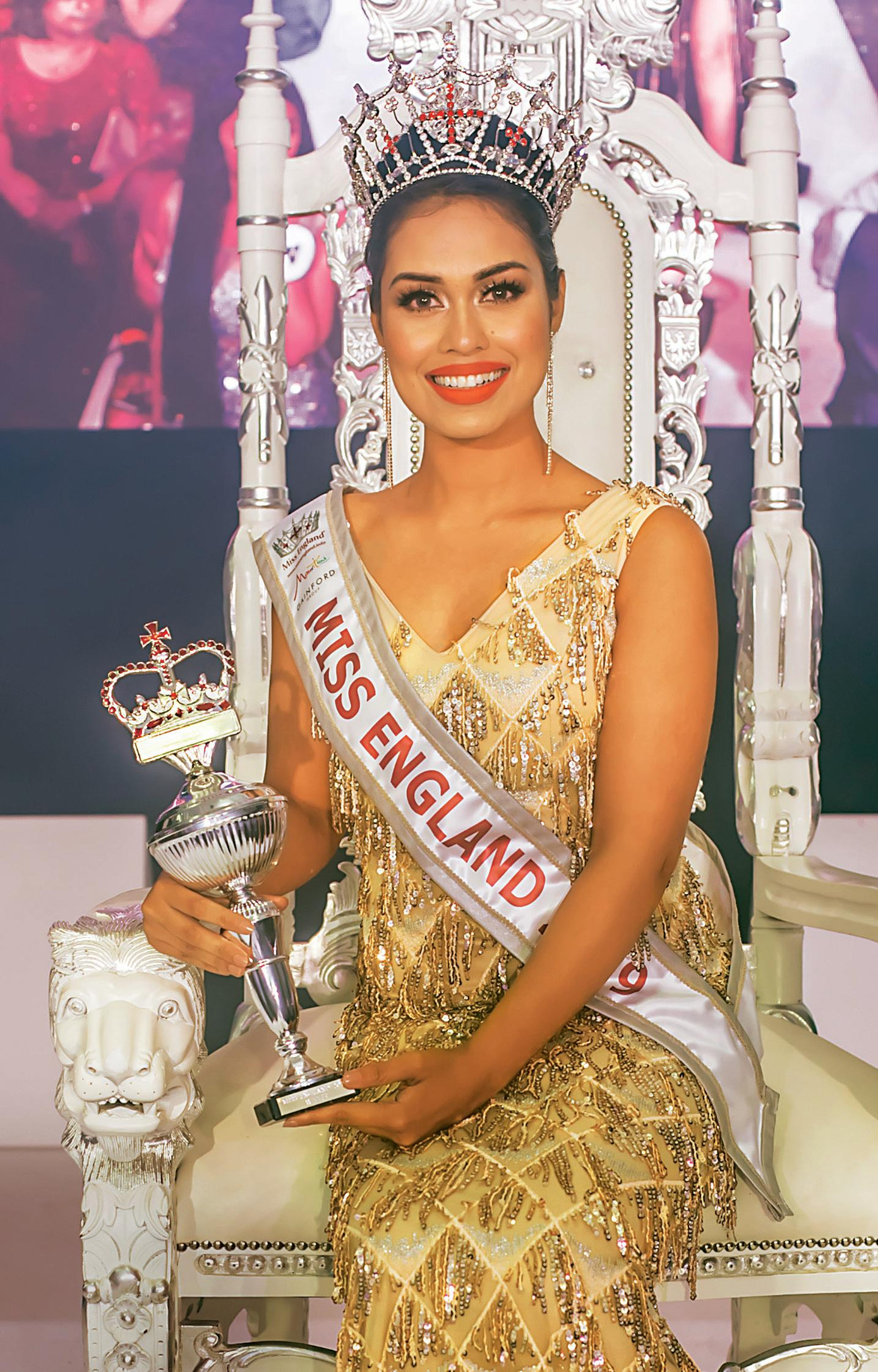 Hoa hậu Anh bị tổn thương mặt vì đeo khẩu trang quá nhiều khi làm bác sĩ chống COVID-19 ảnh 4