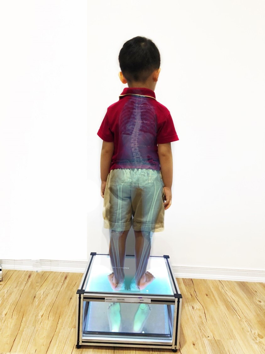 Những bí mật tuyệt vời trong sự phát triển của bé qua từng năm tuổi ảnh 2