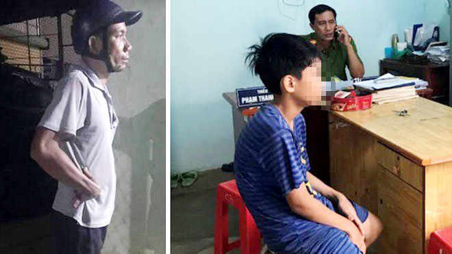 Trộm tiền chơi game, bé trai 12 tuổi bị cha đánh thương tích ảnh 1