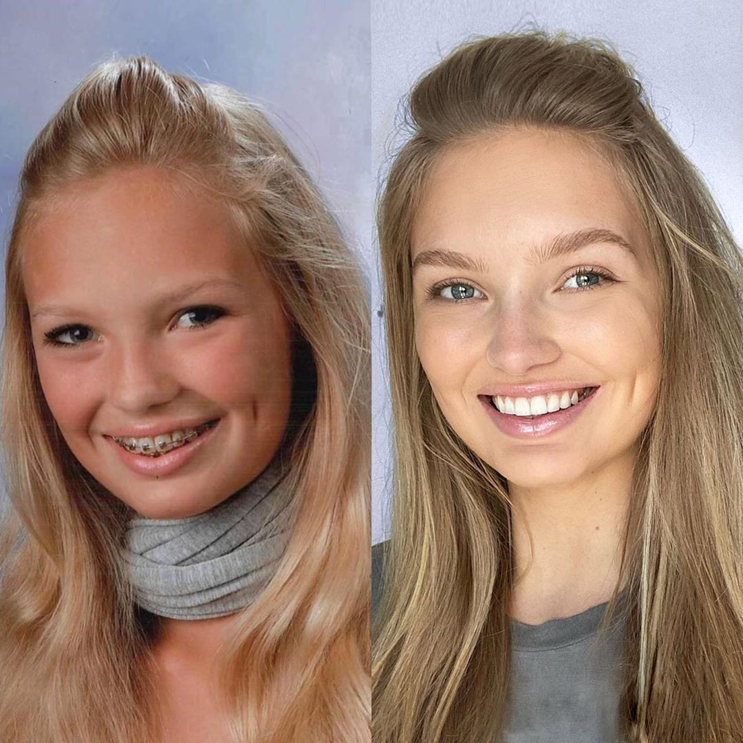 Thiên thần nội y Romee Strijd mặc bikini khoe bụng bầu ảnh 13