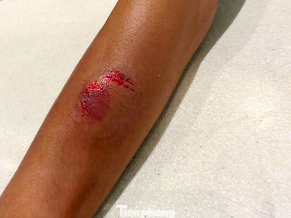  Cắn tay nhân viên hàng không, nữ hành khách bị phạt hơn 7 triệu đồng ảnh 2