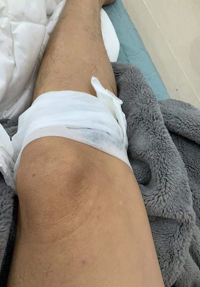 Hoài Linh chia sẻ ảnh bị tai nạn và 'tố' kẻ gây ra thương tích ảnh 1