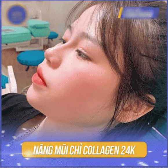 Hình ảnh nghi nâng mũi của bạn gái Quang Hải lan tràn trên mạng ảnh 2