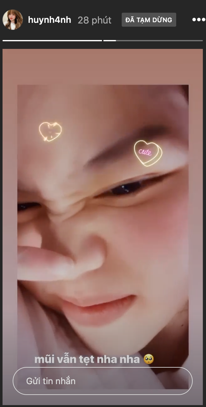 Hình ảnh nghi nâng mũi của bạn gái Quang Hải lan tràn trên mạng ảnh 4