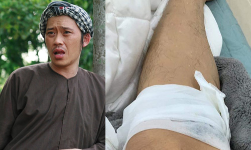 Showbiz 2/7: Xuất hiện tin đồn danh hài Thúy Nga qua đời tại Mỹ ảnh 1