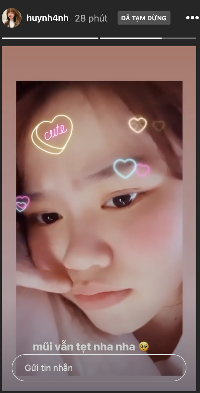 Hình ảnh nghi nâng mũi của bạn gái Quang Hải lan tràn trên mạng ảnh 3