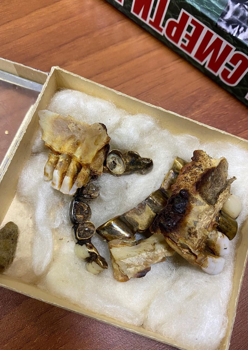 Con gái quan chức Nga bất ngờ hé lộ ảnh hàm răng trùm phát xít Hitler ảnh 4