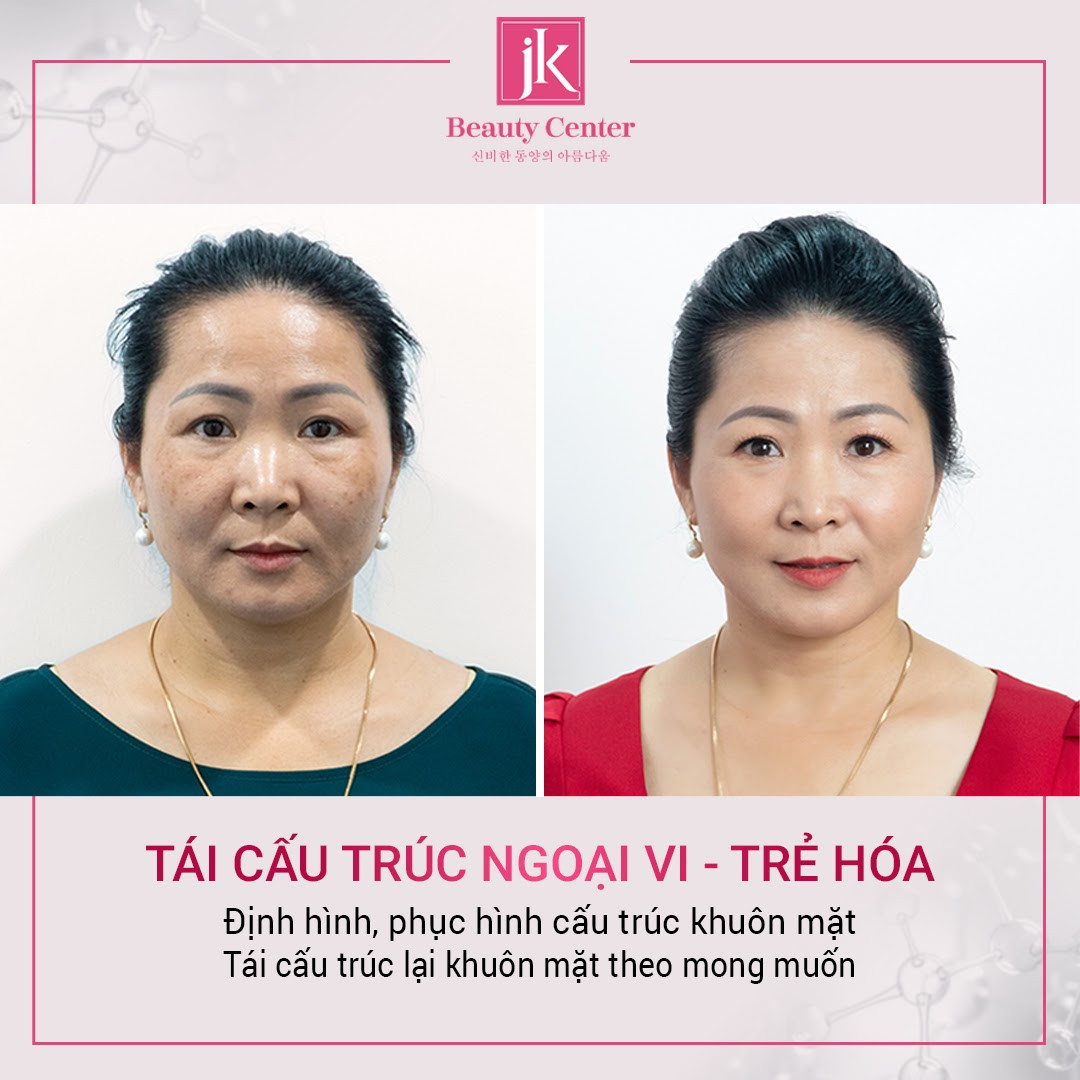 Bí quyết trẻ trung, xinh đẹp như thời thanh xuân của nữ diễn viên Thu Hương ảnh 10