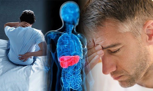 Tỷ lệ mắc ung thư gan ở Việt Nam đứng thứ 3 thế giới ảnh 2