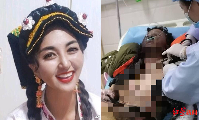 Nữ nghệ sĩ Trung Quốc qua đời sau khi bị chồng tạt xăng thiêu sống ảnh 2