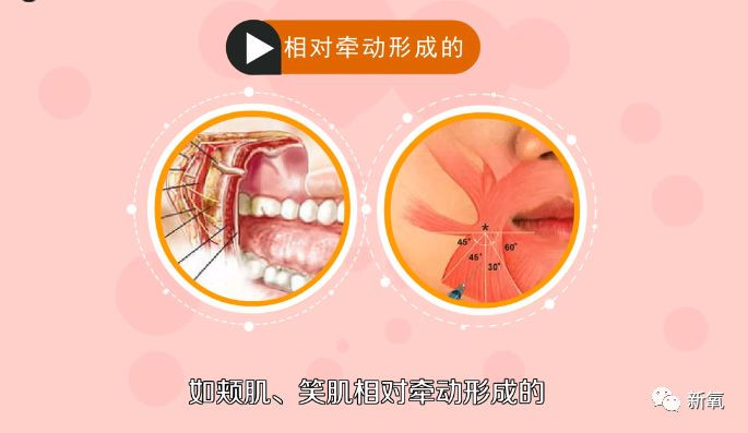 Cô gái trẻ 17 đóng đinh vào má để có má lúm đồng tiền như diễn viên Lê Tư ảnh 4