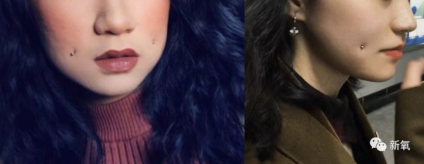 Cô gái trẻ 17 đóng đinh vào má để có má lúm đồng tiền như diễn viên Lê Tư ảnh 1