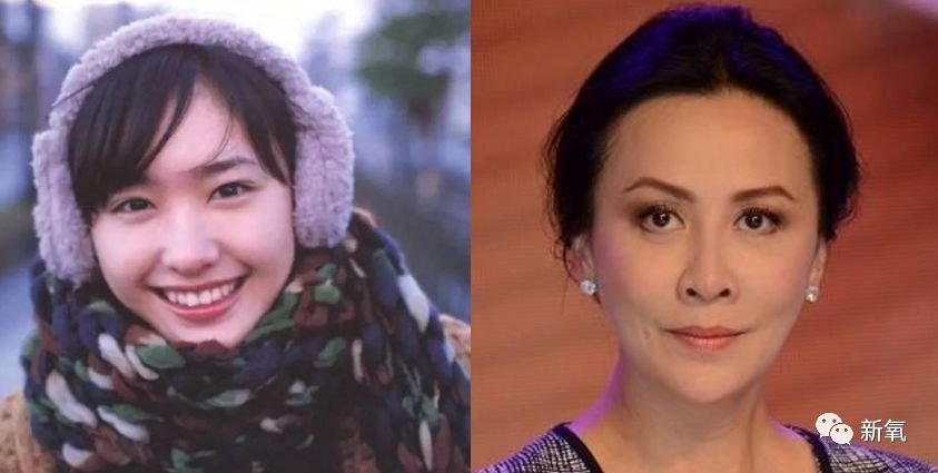 Cô gái trẻ 17 đóng đinh vào má để có má lúm đồng tiền như diễn viên Lê Tư ảnh 6