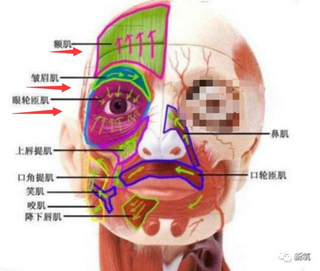 Cô gái trẻ 17 đóng đinh vào má để có má lúm đồng tiền như diễn viên Lê Tư ảnh 3