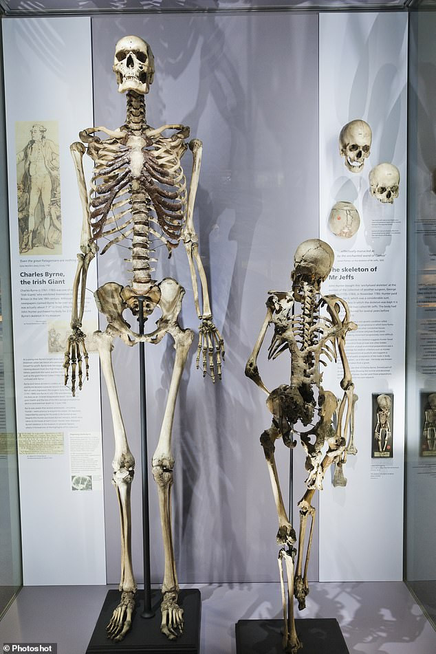 Bi kịch của ‘Người khổng lồ Ireland’: Chết hơn 200 năm không được chôn cất ảnh 4