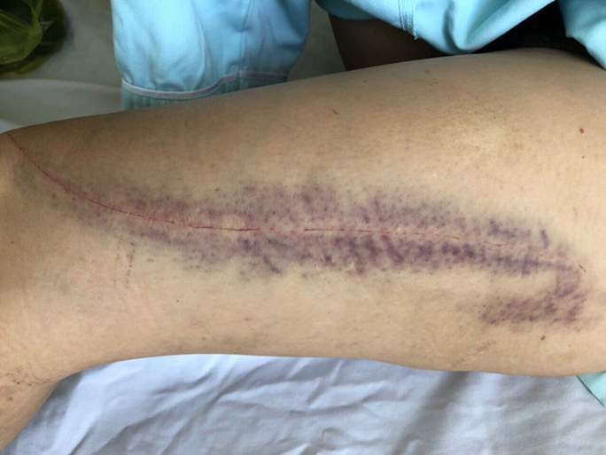 Người đàn bà bị 'phi công trẻ' đuổi chém dã man, lột đồ giữa đường vì ghen ảnh 1