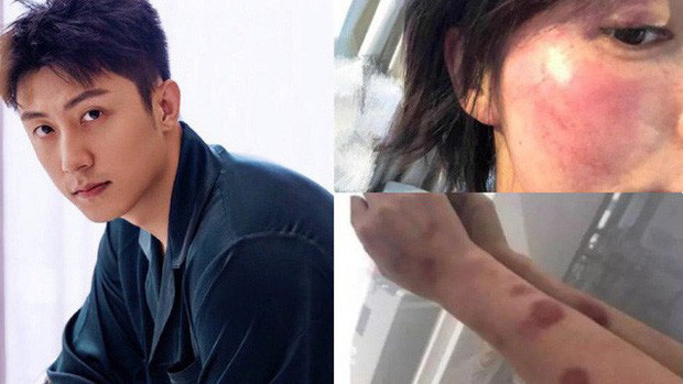 Hội nam thần C-Biz dính “phốt to”: Hoàng Cảnh Du mỗi năm lại bị réo tên một lần ảnh 2