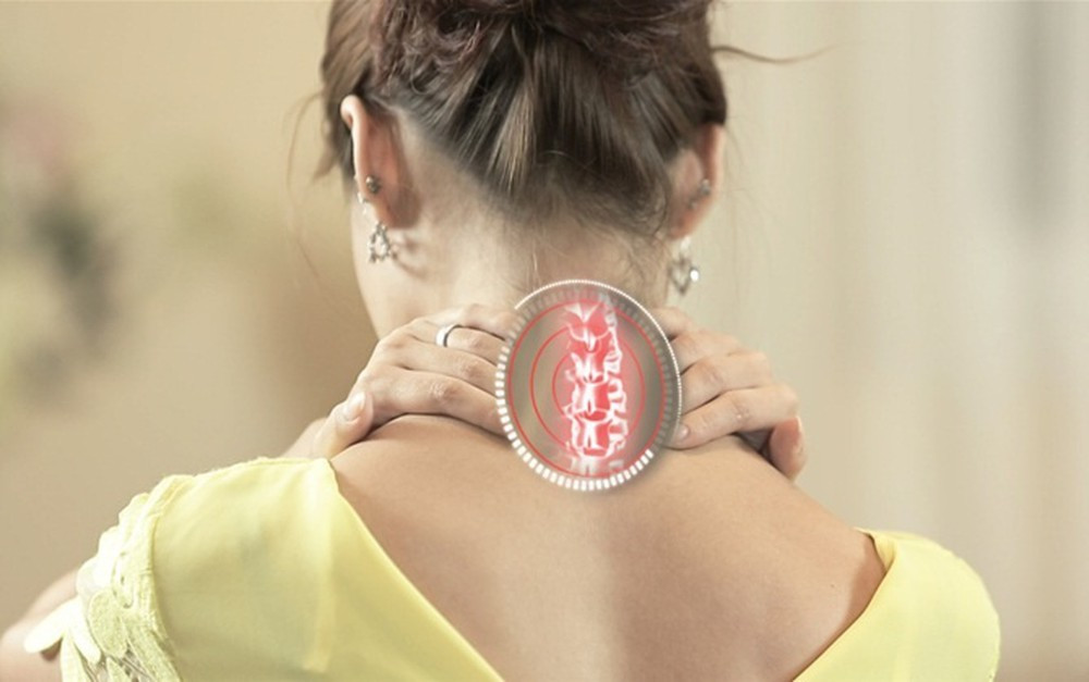 Thoái hóa cột sống cổ: Căn bệnh 'sát thủ' với dân văn phòng ảnh 1