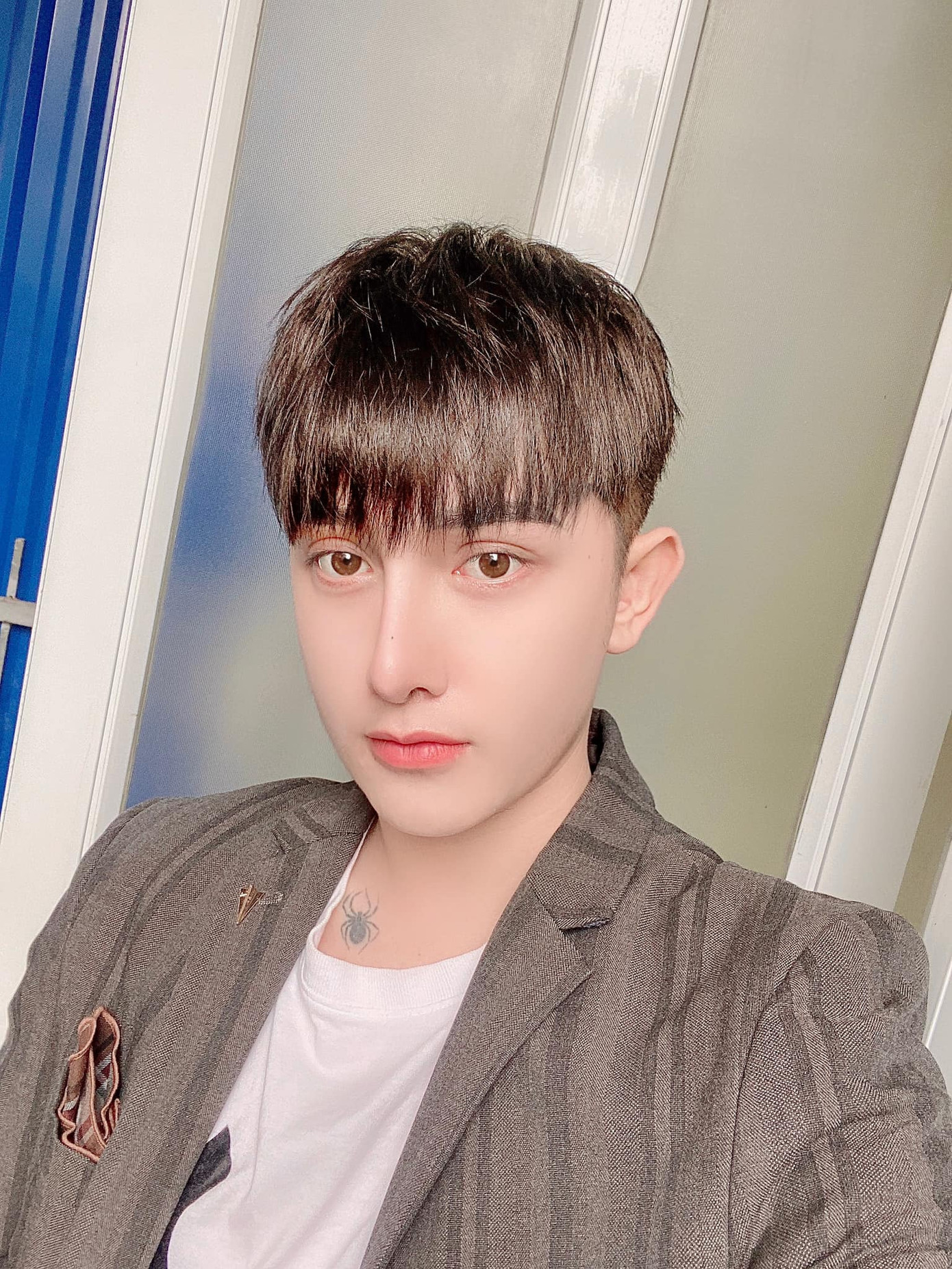 Khoe quá trình “lột xác”, chàng trai gây sốc khi lấy ảnh tội phạm làm ảnh chưa phẫu thuật ảnh 1