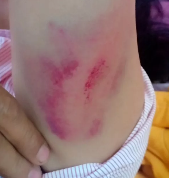 Chánh văn phòng Huyện ủy đánh tài xế nhập viện ảnh 1