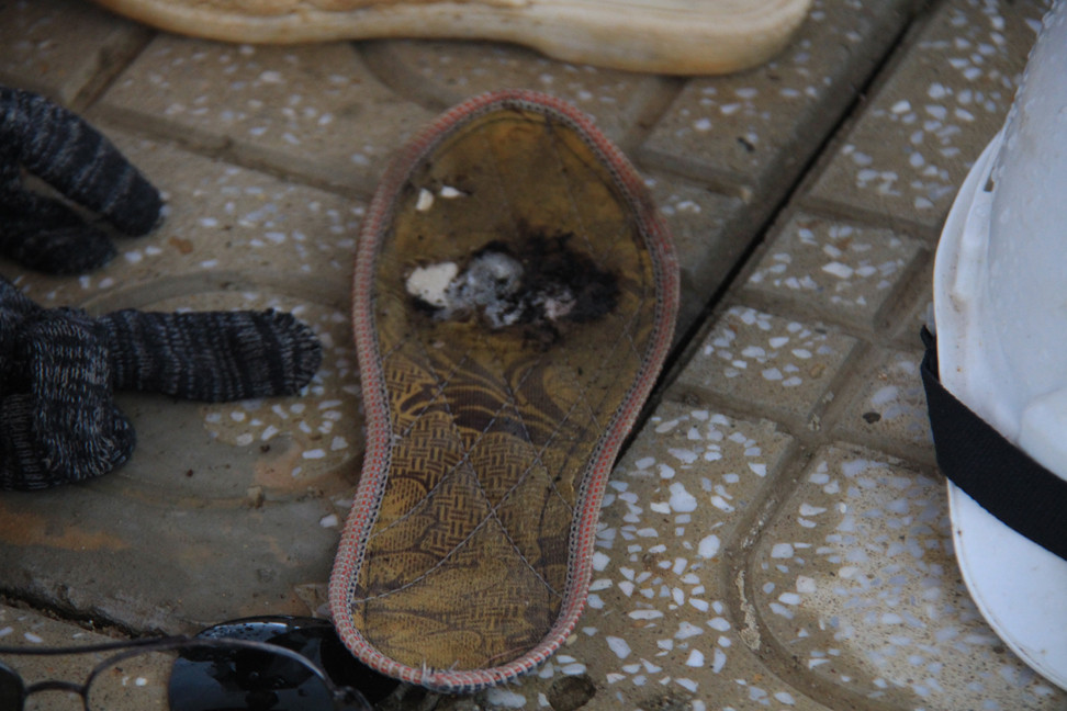 Dựng xà gồ thi công, 11 người bị điện giật thương vong ảnh 2