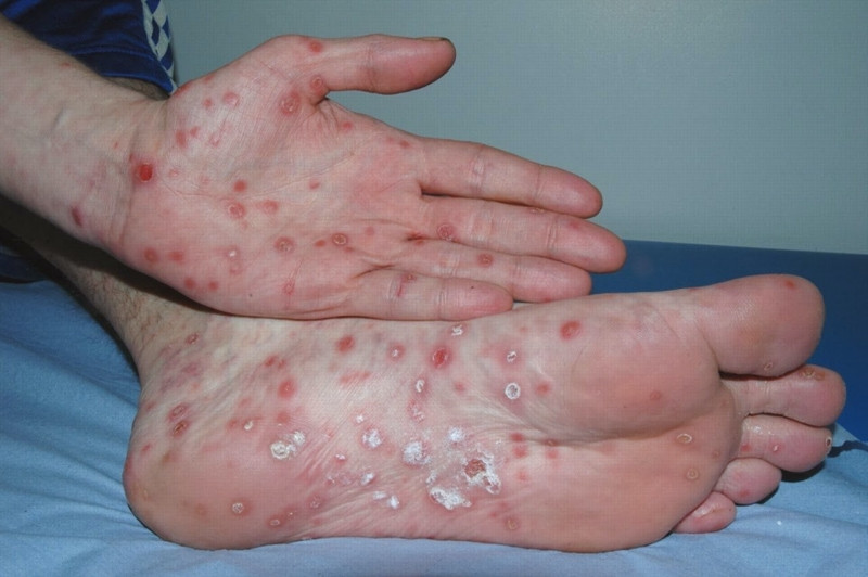 “Cậu nhỏ” sưng đau, nam thanh niên giật mình khi biết nguyên nhân từ “bạn gái trên mạng“ ảnh 2