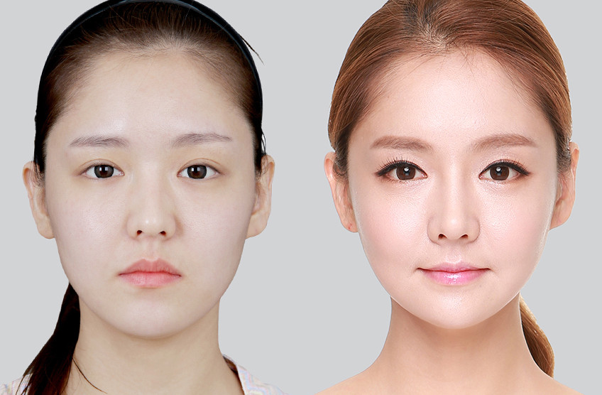 Định hình khuôn mặt Mewing: “Hô biến” cho khuôn mặt sắc nét không cần dao kéo? ảnh 2