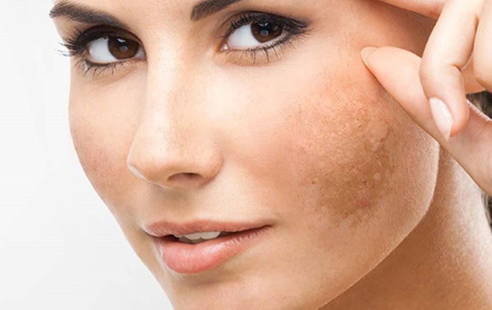 Loạt thói quen tưởng chừng vô hại hóa ra lại là “kẻ thù giấu mặt” của da mặt ảnh 1