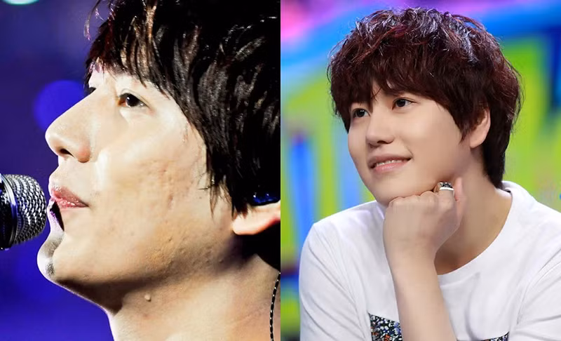 Sốc với hình ảnh làn da của các idol bị tàn phá do phải trang điểm quá nhiều ảnh 8