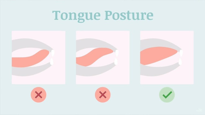 Định hình khuôn mặt Mewing: “Hô biến” cho khuôn mặt sắc nét không cần dao kéo? ảnh 1